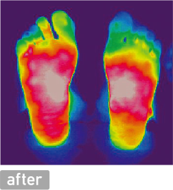 Our Sole Comfort - Blood Care